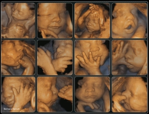 3D и 4D фото плода во время беременности - разница