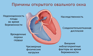 Овальное окно в сердце у новорожденного