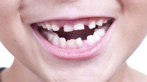 Как меняются зубы у детей