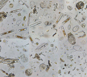Под микроскопом йодофильная флора