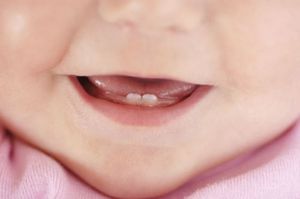 Прорезывание зубов: сроки и симптомы