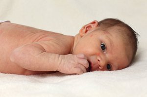 Лечение сыпи у новорожденных