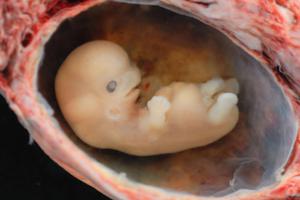 Эмбрион на пятой неделе