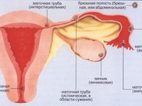 Как определить внематочную беременность