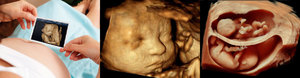 Что может показать 3D УЗИ при беременности