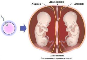 Как наступает беременность двойней