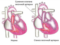 Причины заболевания