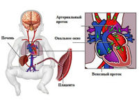 Проблемы с сердцем у новорожденных