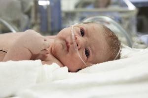 Врожденный стридор у новорожденных -как лечить