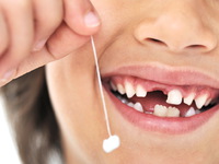 Выпадение молочных зубов у детей