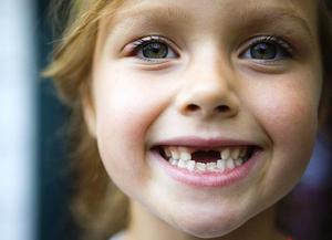 Смена молочных зубов у детей