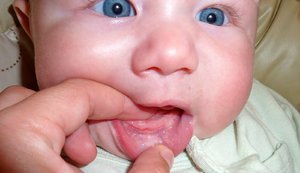 Прорезывание зубов у ребёнка