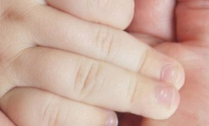Белые пятна на ногтях могут говорить о нехватке кальция