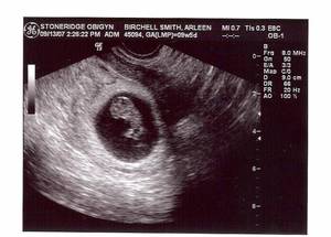 Эмбрион 9 недель беременности