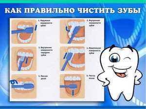 Выбор зубной щетки