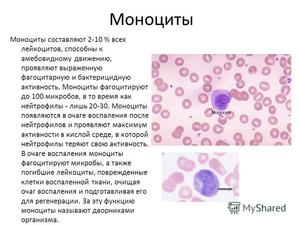 Повышение моноцитов в крови